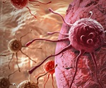 Estrogen-positive tumors drive rising breast cancer rates in young women