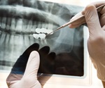 New guidelines prioritize safe and effective dental X-rays