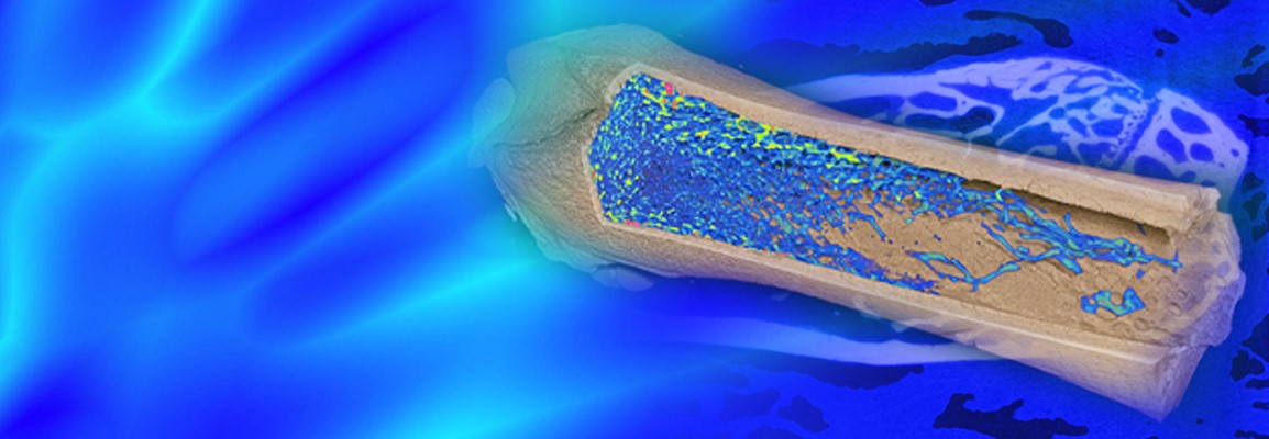 Using Micro-CT Imaging for the Phenotyping and Analysis of Bone Architecture