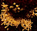 Prior mycobacterium exposure remodels immune cells, impacting tuberculosis defense