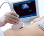 Doppler ultrasound detects placental issues in small babies, study finds